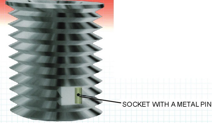 OVERSIZE BIG-SERT thread repair for badly damaged hole